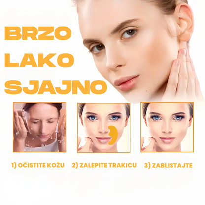 Trakice za Osmeh bez Bora