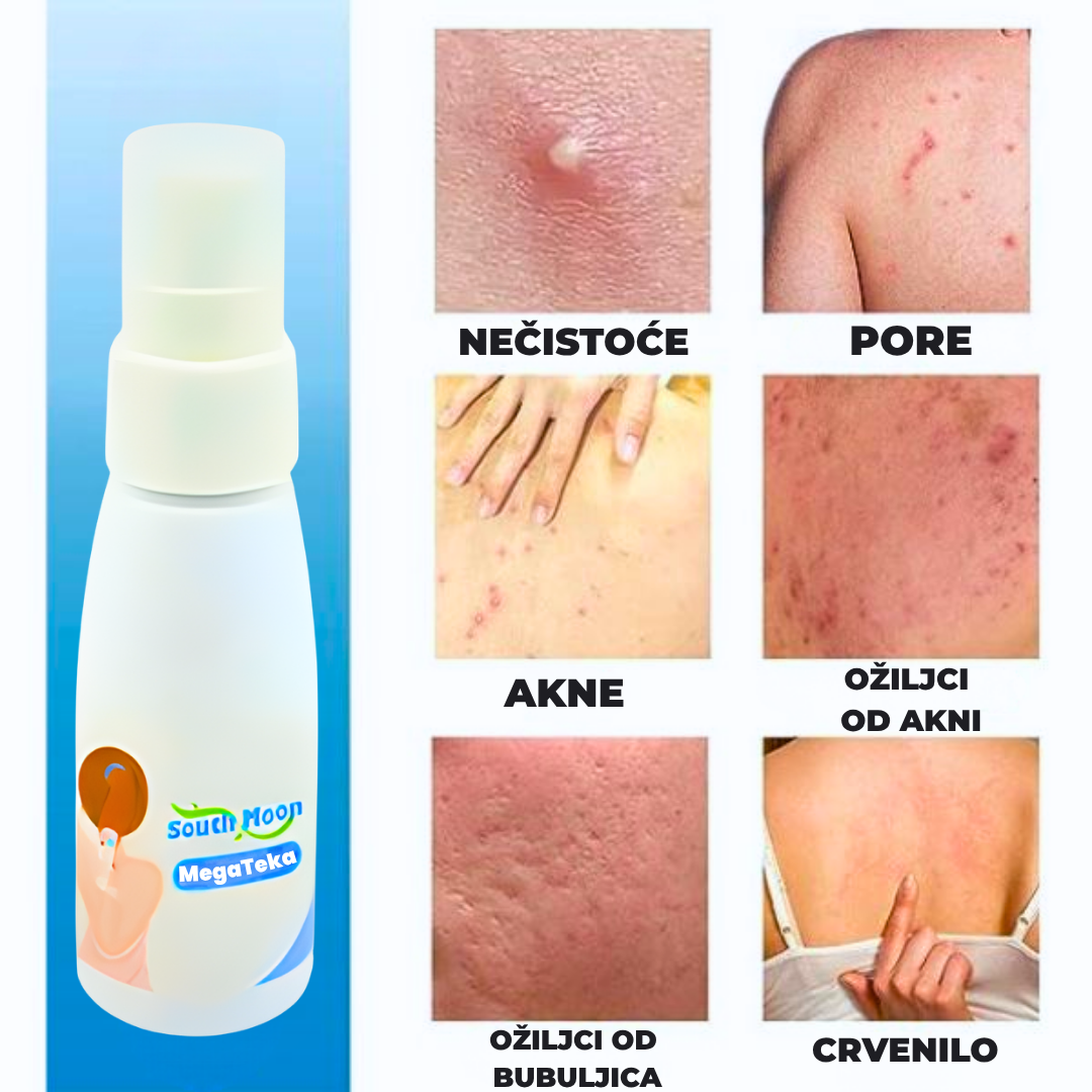 Sprej za Akne na Ledjima